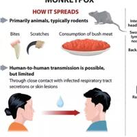 waspada-virus-monkeypox-atau-cacar-monyet-semakin-menyebar-di-eropa-dan-amerika