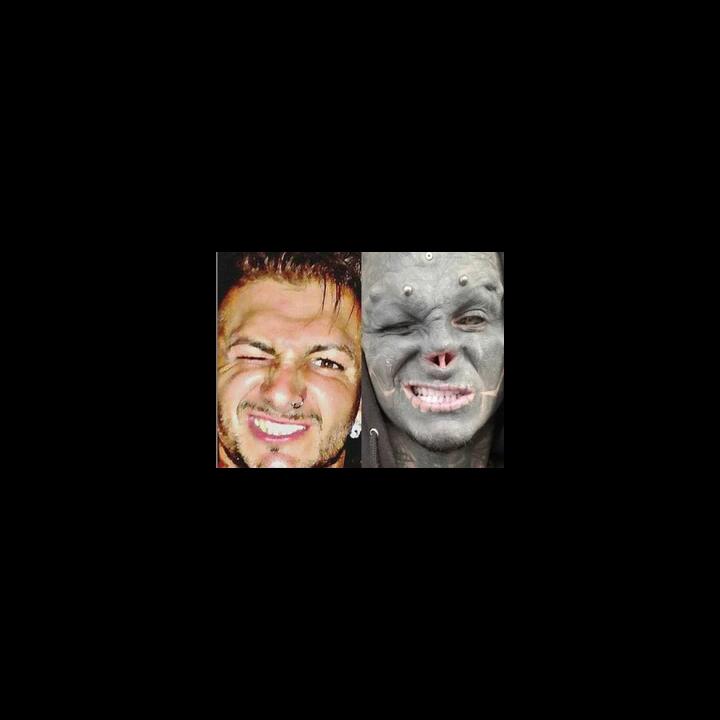 Pria Ini Rela Motong Hidung dan Bibirnya Demi Mirip Black Alien