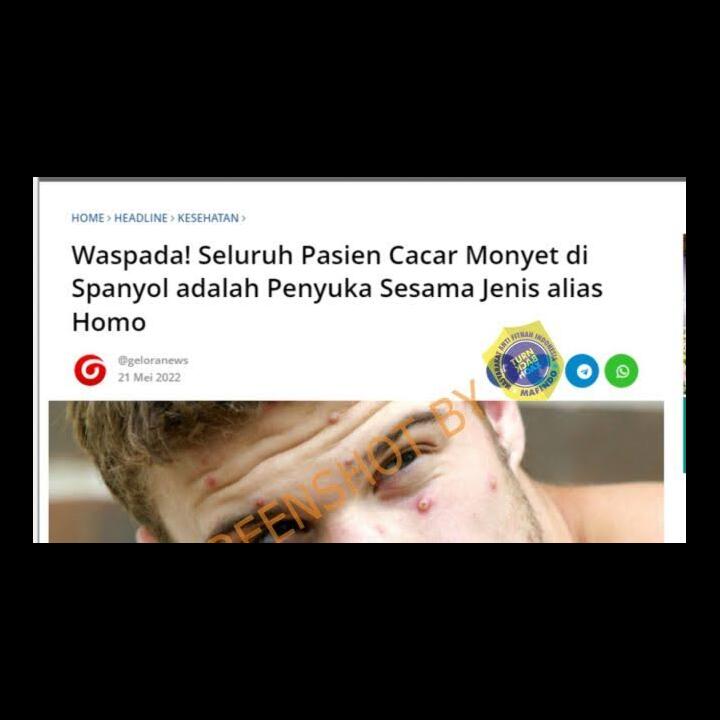 Cacar Monyet Kok Gak Ada Monyetnya? Lebih Menular Pada Pria Homo/Gay