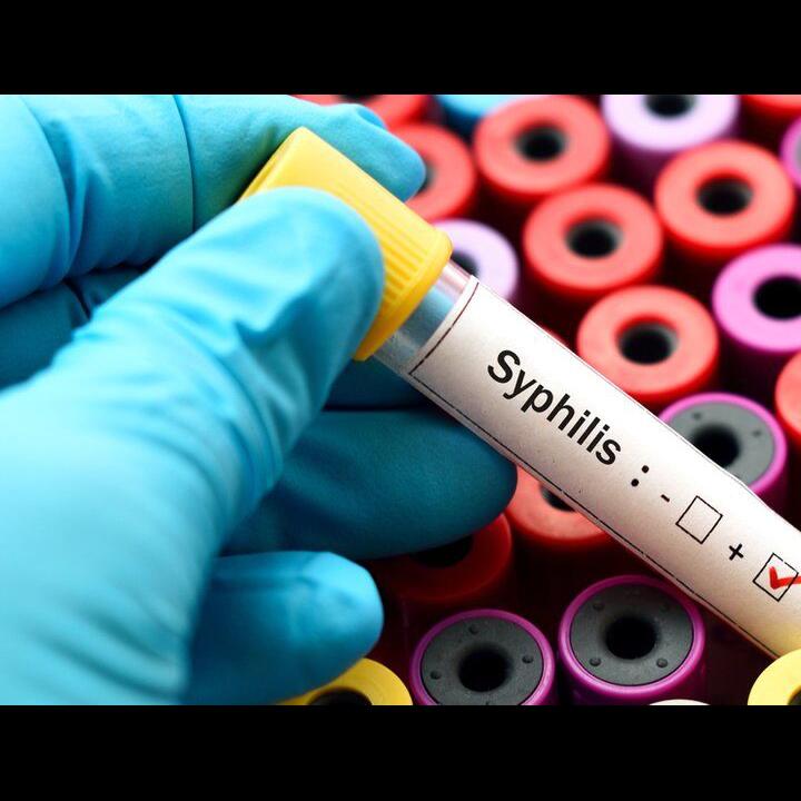 Sifilis dan HIV Meledak, Wabah Penyakit Menular Seksual di Amerika Tidak Terkendali