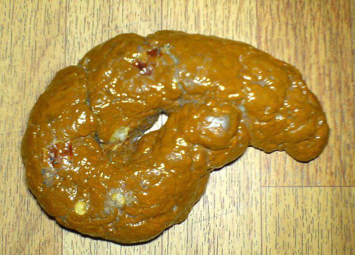 kebelet ngising