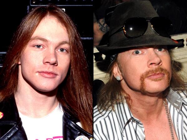 Perbedaan Axl Rose Dulu dan sekarang