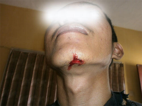 Hasil salto dari mobil
