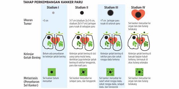 Kanker Paru Makin Banyak Diderita Bukan Perokok