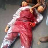 Saksi: Korban Tawuran di Jl Minangkabau Terkena Celurit