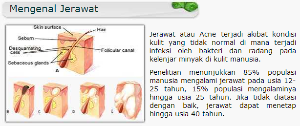 Ebook Program Intensif 21 Hari Menghilangkan Jerawat & Bekas Jerawat Secara Alami