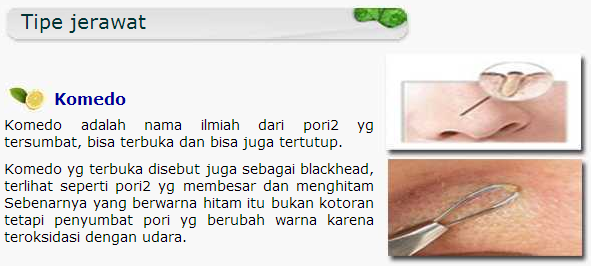Ebook Program Intensif 21 Hari Menghilangkan Jerawat & Bekas Jerawat Secara Alami
