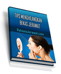 Ebook Program Intensif 21 Hari Menghilangkan Jerawat & Bekas Jerawat Secara Alami