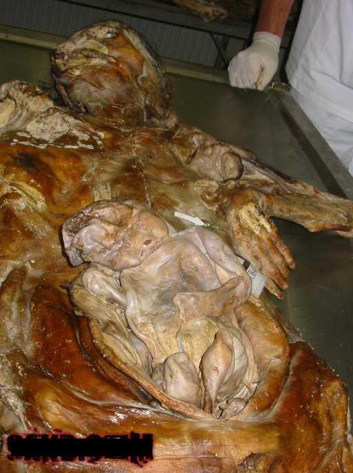 a very rotten mum and baby
