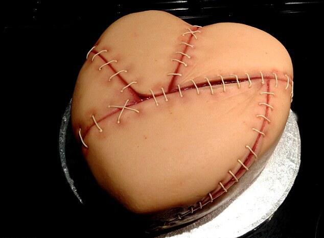 Kue Seram Bentuk Organ Tubuh Manusia Kena Penyakit