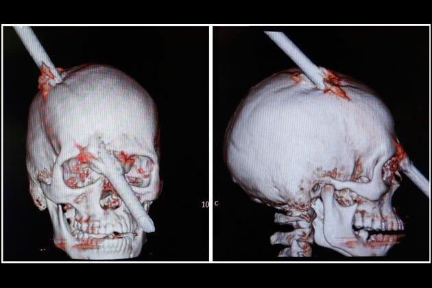 Foto X-Ray Paling Mencengangkan..!!!