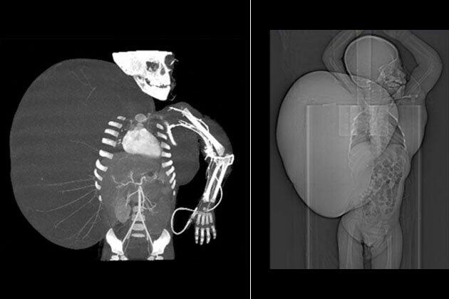 Foto X-Ray Paling Mencengangkan..!!!