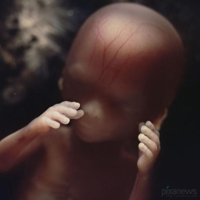 &quot;A Child is Born&quot;, Fotografi Transformasi Sperma Hingga Janin