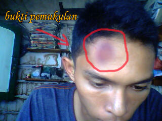 MENURUT AGAN BENAR ATAU SALAH TINDAKAN ANE...!!!!