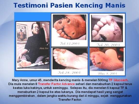GRATIS... UNTUK ANTI BODY (Sistem Imun Tubuh)