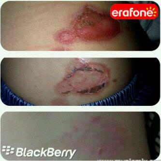 NANO SPRAY !!! SOLUSI MASALAH KULIT UNTUK COWO &amp; CEWE