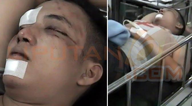 Duh, Ini Korban Diego Michels