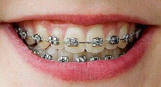 behel fashion harga grosir @40.000