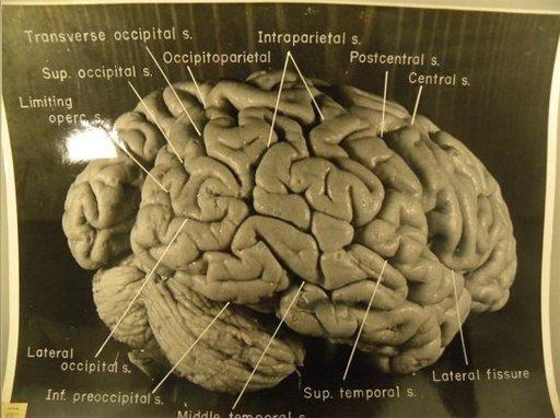 Gini gan foto otak Einstein