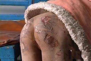 Foto Pantat Tingting