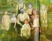 10 penyakit langka paling aneh di dunia 