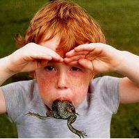 10 penyakit langka paling aneh di dunia 