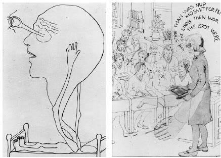 10 penyakit langka paling aneh di dunia 