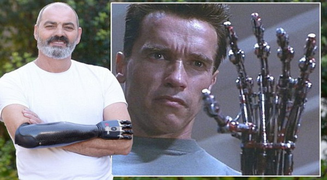 Pria dengan Tangan Robot &quot;Terminator&quot;