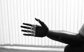 Pria dengan Tangan Robot &quot;Terminator&quot;
