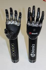Pria dengan Tangan Robot &quot;Terminator&quot;