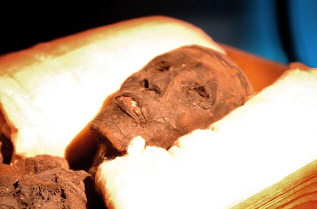--Kematian Firaun Tutankhamen Di Akibatkan Epilepsi--