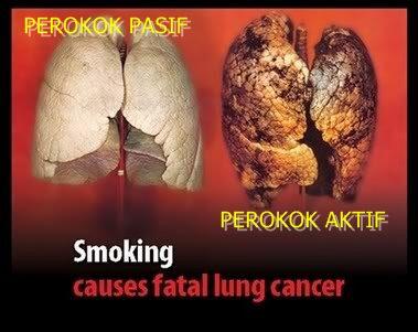 Seberapa Efektifkah Busa Rokok Mengurangi Bahaya Asap Rokok?