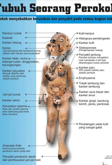 &#91;HOT&#93; Kerjaan yang paling &quot;BEGO &amp; KONYOL&quot; Sedunia &#91;NO OFFENSIVE&#93;