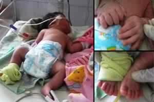 Bayi Ini Lahir Pada Tanggal 12-12-12 dan Memiliki 12 Jari