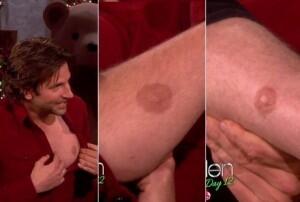 Pria ini punya 5 Puting Susu ! 