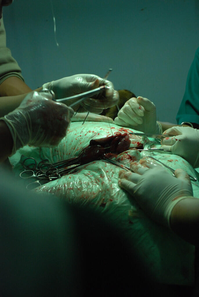 Mengintip proses rusa melahirkan cesar gan ( foto ane sendiri )