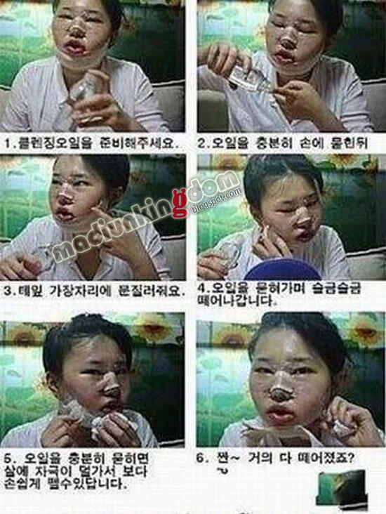 Proses Operasi Plastik, Rahasia Kecantikan Artis Korea