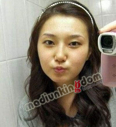 Proses Operasi Plastik, Rahasia Kecantikan Artis Korea