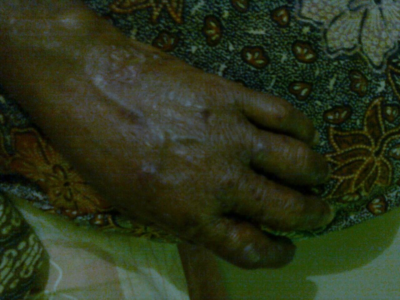 &#91;ASK&#93; ada yang bia terawangin nih penyakit gak mbah? nenek ane kasihan nih :-(