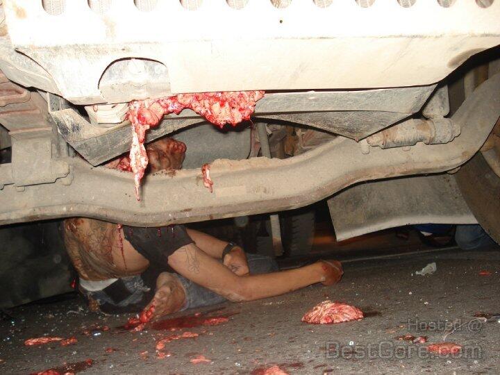 Hit By Truck part II
