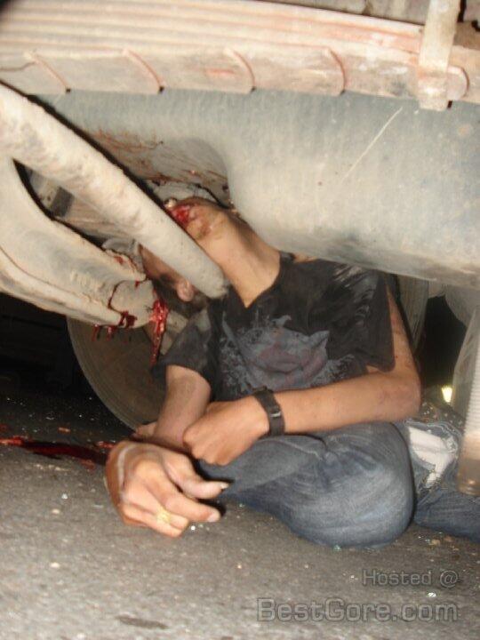 Hit By Truck part II