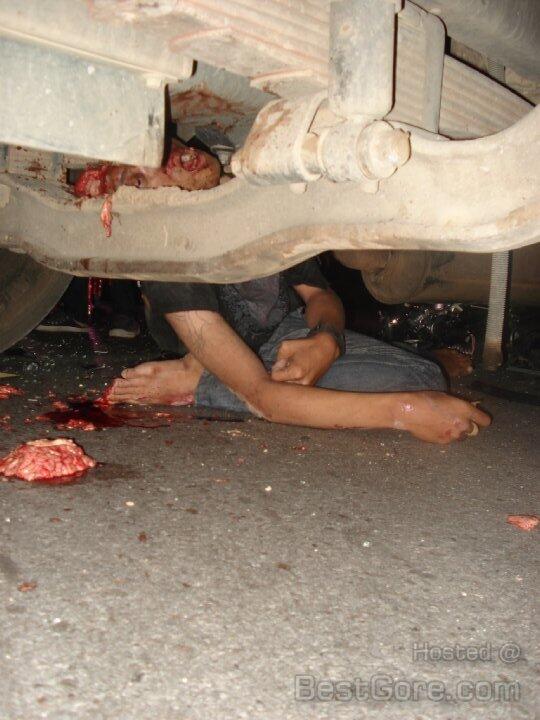 Hit By Truck part II