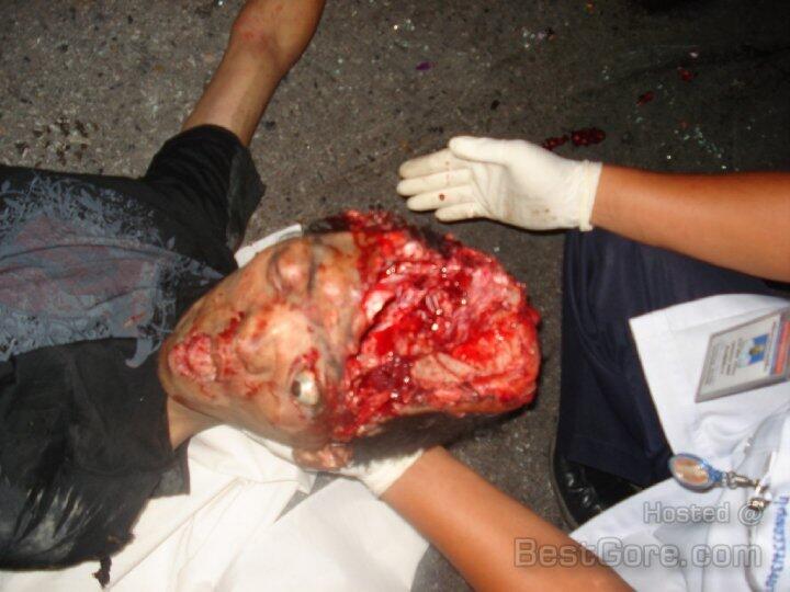 Hit By Truck part II