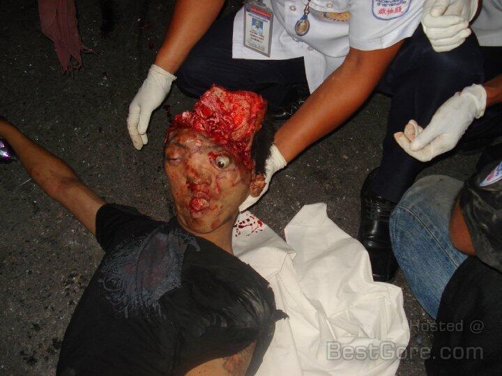 Hit By Truck part II