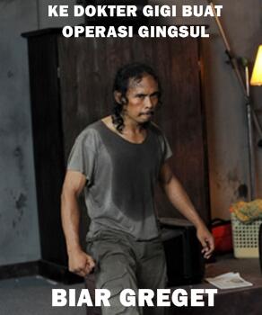 Gigi Gingsul, Trend Baru Cewek-Cewek Jepang