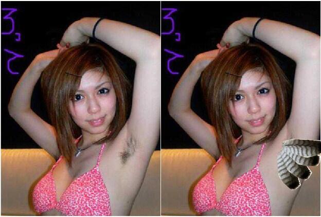 Bulu Kaki? Salah! yang benar Rambut Kaki