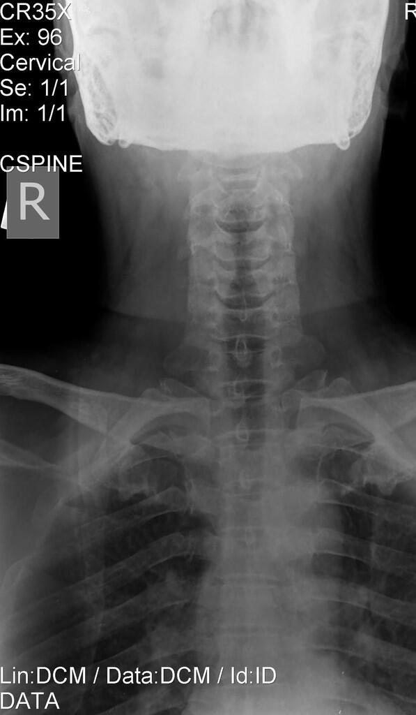 Hasil Foto Camera Radiografi Diagnostik, gak kalah sama SLR..