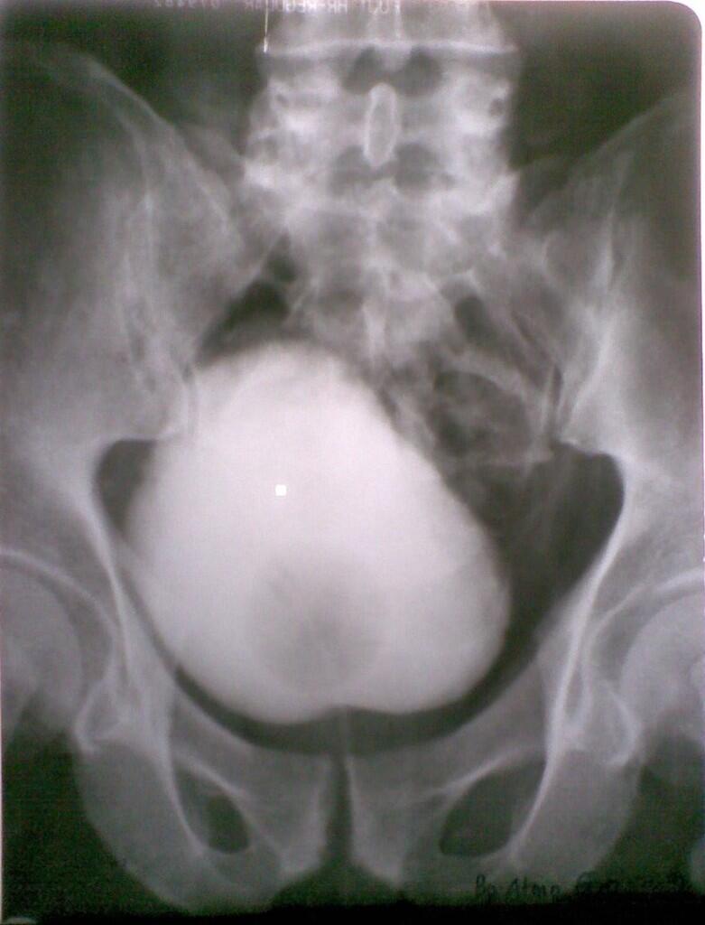 Hasil Foto Camera Radiografi Diagnostik, gak kalah sama SLR..