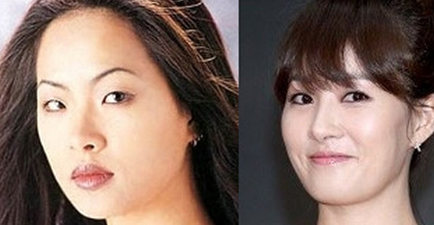 &lt;B&gt; 14 Artis Korea yang Berubah Dari Jelek ke Cantik&lt;/B&gt;