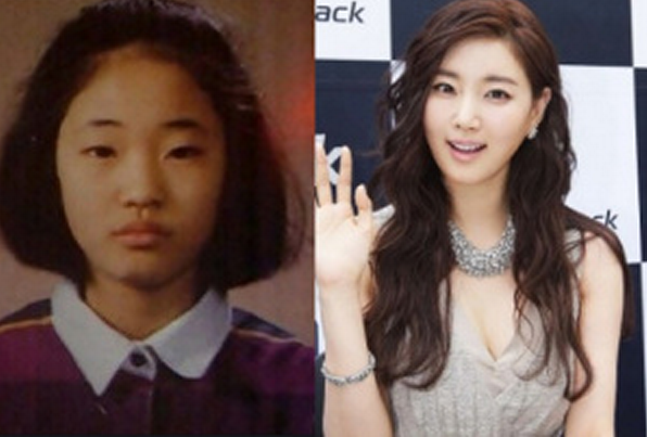 &lt;B&gt; 14 Artis Korea yang Berubah Dari Jelek ke Cantik&lt;/B&gt;